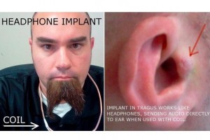 earbuds_implants