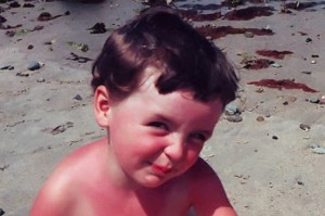512px-Sunburn_flickr_02