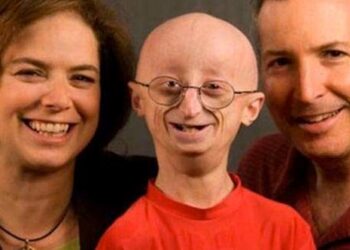 “Έφυγε” ο Σαμ Μπερνς!