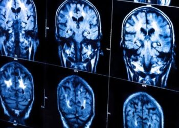 Τα σοβαρά τραύματα στο κεφάλι τριπλασιάζουν τον κίνδυνο πρόωρου θανάτου