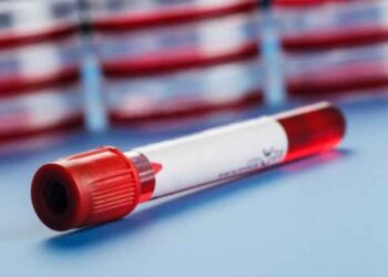 Πώς θα καταλάβετε ότι έχει πέσει ο αιματοκρίτης σας