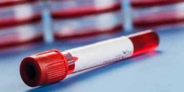 Πώς θα καταλάβετε ότι έχει πέσει ο αιματοκρίτης σας