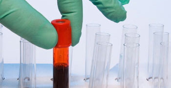 Εθελοντική αιμοδοσία στη Θρακική Εστία Εορδαίας