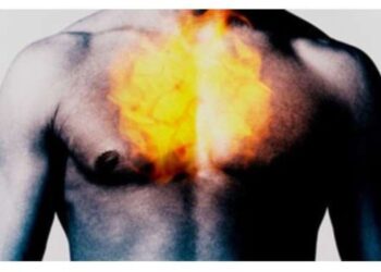 5 φυσικές θεραπείες για την καούρα, πιο αποτελεσματικές από τα φάρμακα