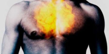 5 φυσικές θεραπείες για την καούρα, πιο αποτελεσματικές από τα φάρμακα