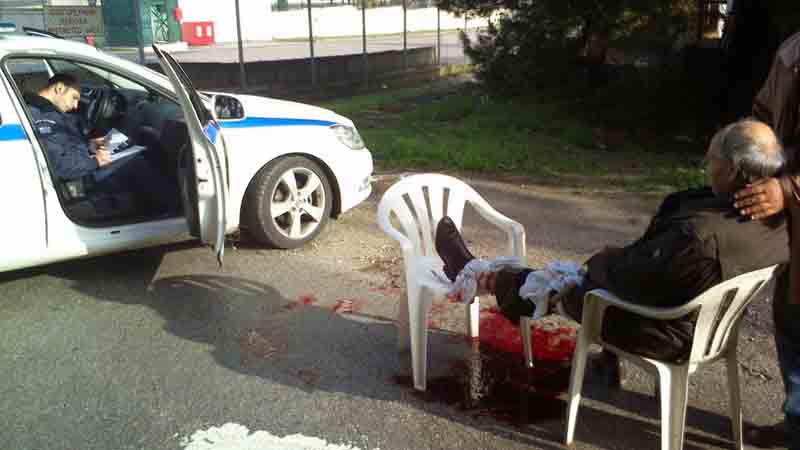 epithesi skilion se anthropo03