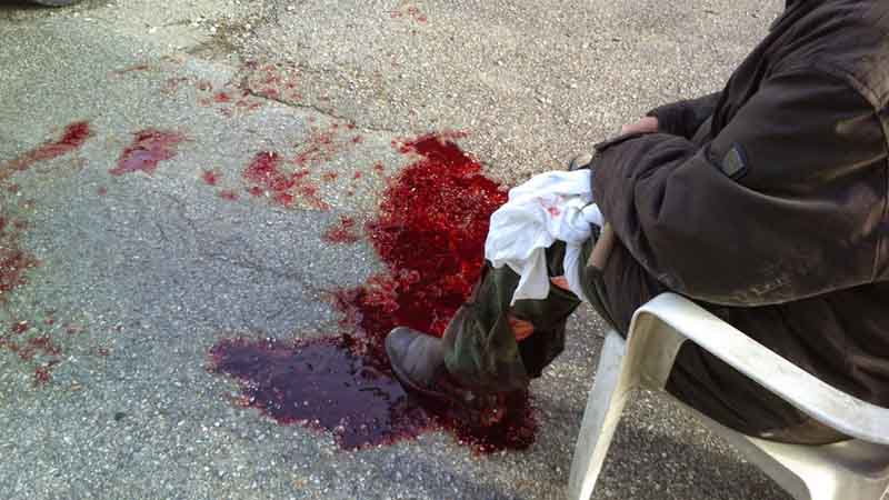 epithesi skilion se anthropo05