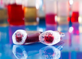 Ανακάλυψαν 5 νέα γονίδια που σχετίζονται με το κοιλιακό λίπος