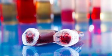 Ανακάλυψαν 5 νέα γονίδια που σχετίζονται με το κοιλιακό λίπος