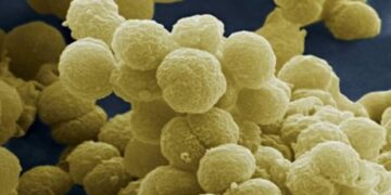 Νέο τεστ για τη διάγνωση της μηνιγγίτιδας