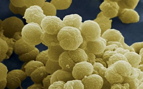 Νέο τεστ για τη διάγνωση της μηνιγγίτιδας