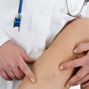 Φάκελος ευρυαγγείες: Όλα όσα θέλεις να ξέρεις