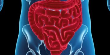 ΗΠΑ: Νέο αποτελεσματικό τεστ για τη διάγνωση του καρκίνου του εντέρου