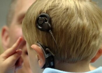 Πρωτοποριακό εμφύτευμα κατά της κώφωσης