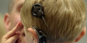 Πρωτοποριακό εμφύτευμα κατά της κώφωσης