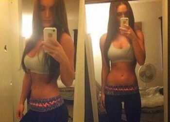 Κοπέλα πέθανε μετά από 12 ώρες συνεχόμενου σ3ξ