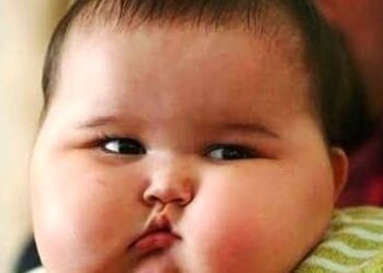 Το 65% των υπέρβαρων παιδιών και εφήβων έχουν ανεπάρκεια ή έλλειψη βιταμίνης D!