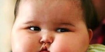 Το 65% των υπέρβαρων παιδιών και εφήβων έχουν ανεπάρκεια ή έλλειψη βιταμίνης D!