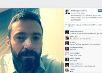 Σε δεύτερη επέμβαση για αφαίρεση καρκινώματος στο δέρμα υποβλήθηκε ο Χιου Τζάκμαν