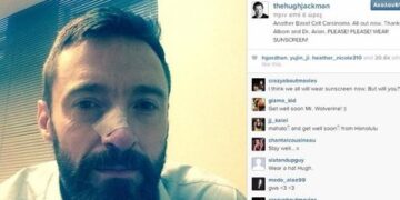 Σε δεύτερη επέμβαση για αφαίρεση καρκινώματος στο δέρμα υποβλήθηκε ο Χιου Τζάκμαν