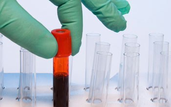 Εθελοντική αιμοδοσία από τον ¨Σπάρτακο¨