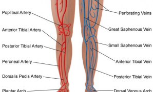 Ενημερωτική εκδήλωση για τη φλεβική θρόμβωση