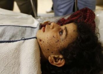 Νετανιάχου: «Λυπούμαστε αλλά για τους νεκρούς αμάχους φταίει η Χαμάς»