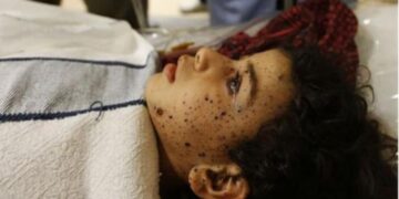 Νετανιάχου: «Λυπούμαστε αλλά για τους νεκρούς αμάχους φταίει η Χαμάς»