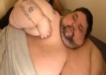 Η τραγική ιστορία του πιο χοντρού άνδρα στον κόσμο – Πώς κατέληξε να «φάει» τον ίδιο τον εαυτό του [εικόνες]