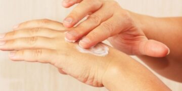 Πώς θα απαλλαγείτε από τις κρεατοελιές