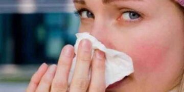 Περισσότερα βαριά περιστατικά γρίπης αναμένονται φέτος σε σύγκριση με τα άλλα έτη