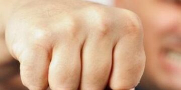 Κοζάνη: Της επιτέθηκαν στο στάβλο της για 250 ευρώ