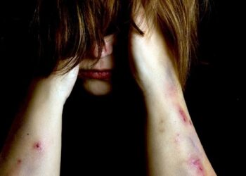 Σύμφωνο συνεργασίας του Δήμου Εορδαίας με το Ινστιτούτο Υγείας του Παιδιού – Διάγνωση και διαχείριση περιστατικών κακοποίησης και παραμέλησης παιδιών