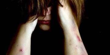 Σύμφωνο συνεργασίας του Δήμου Εορδαίας με το Ινστιτούτο Υγείας του Παιδιού – Διάγνωση και διαχείριση περιστατικών κακοποίησης και παραμέλησης παιδιών