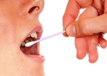 Κάλεσμα του Σωματείου «ΣΠΑΡΤΑΚΟΣ» σε διαδικασία λήψης στοματικού επιχρίσματος για την εύρεση δοτών μυελού των οστών