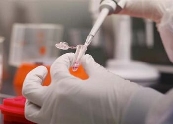 Νέα πρωτοποριακή θεραπεία αντιμετώπισης της αρθρίτιδας του αντίχειρα