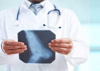 Ενημερωτική εκδήλωση για την Οστεοπόρωση στο Α΄ ΚΑΠΗ Πτολεμαΐδας