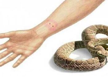 Κι άλλο κρούσμα με δηλητηριώδες τσίμπημα φιδιού στην Εορδαία – Στο Μηλοχώρι αυτή τη φορά!