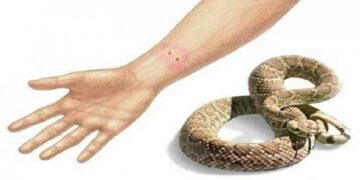 Κι άλλο κρούσμα με δηλητηριώδες τσίμπημα φιδιού στην Εορδαία – Στο Μηλοχώρι αυτή τη φορά!