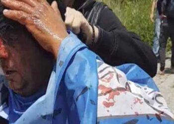 Η σημαία με τα αίματα – Εικόνες με τον τραυματισμένο διαδηλωτή στις Πρέσπες  (Βίντεο)