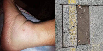 Διαμαρτυρία πολίτη: Έπαθε ατύχημα σε σπασμένα πλακάκια σε οδό της Πτολεμαΐδας – “Αστοχία υλικού”  – Βολές και κατά του Δήμου