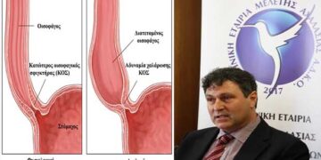 Ο Πόντιος γιατρός Νίκος Ελευθεριάδης από την Άρδασσα, που θεραπεύει ασθενείς με σπάνια πάθηση