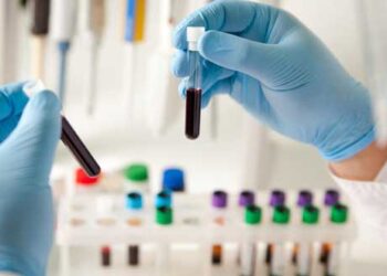 Αναστολή των κινητοποιήσεων για τα διαγνωστικά Κέντρα και σε Κοζάνη – Πτολεμαΐδα