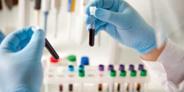 Αναστολή των κινητοποιήσεων για τα διαγνωστικά Κέντρα και σε Κοζάνη – Πτολεμαΐδα