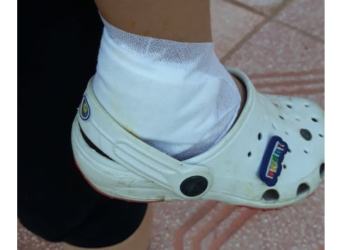 Αγέλη σκύλων επιτέθηκε σε 3,5 ετών παιδί και στη μητέρα του στην Πτολεμαΐδα – Τους δάγκωσε σκύλος και κατέληξαν στο Μποδοσάκειο