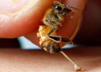 Τι κάνουμε αν μας τσιμπήσει μέλισσα ή σφήκα;