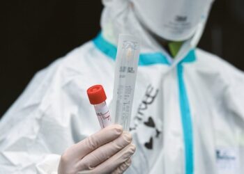 Κορωνοϊός: 2556 νέα κρούσματα και τραγικό αρνητικό ρεκόρ με 34 θανάτους σήμερα 7/11