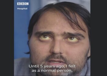 Η συγκινητική ιστορία ζωής του ψυχιάτρου Τριαντάφυλλου Τριανταφυλλίδη που λόγω σπάνιας πάθησης χρειάστηκε και έκανε μεταμόσχευσης ήπατος, βγαίνοντας νικητής – Η ιστορία του έγινε Ρεπορτάζ στο BBC (video)