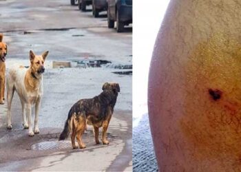 Πτολεμαΐδα: Νέο περιστατικό με αδέσποτα σκυλιά που επιτέθηκαν και δάγκωσαν 16χρονο μαθητή