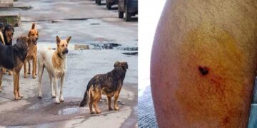 Πτολεμαΐδα: Νέο περιστατικό με αδέσποτα σκυλιά που επιτέθηκαν και δάγκωσαν 16χρονο μαθητή